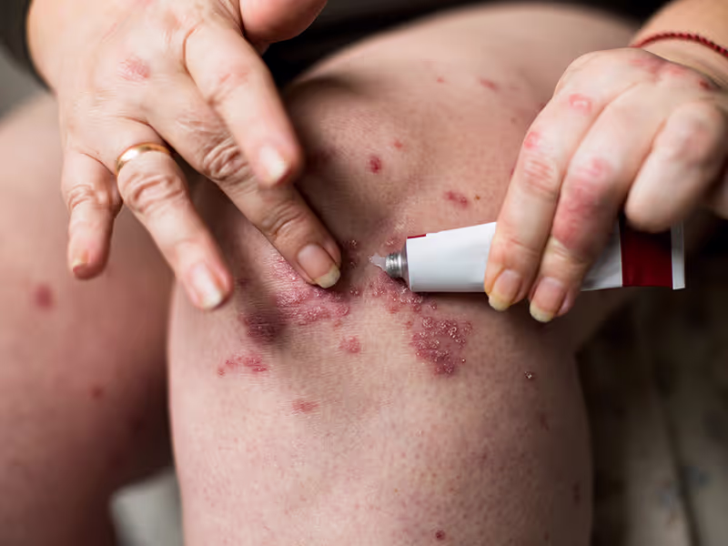 The Science of Dermatological Compounding