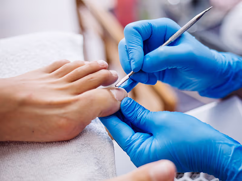 Common Foot Conditions We Treat