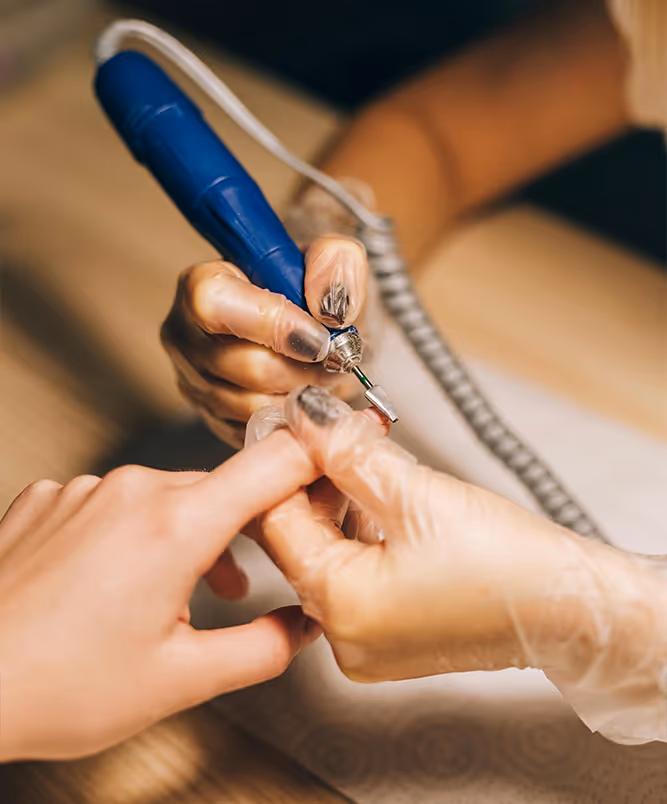 Urea-based nail avulsion — non-surgical nail removal treatment