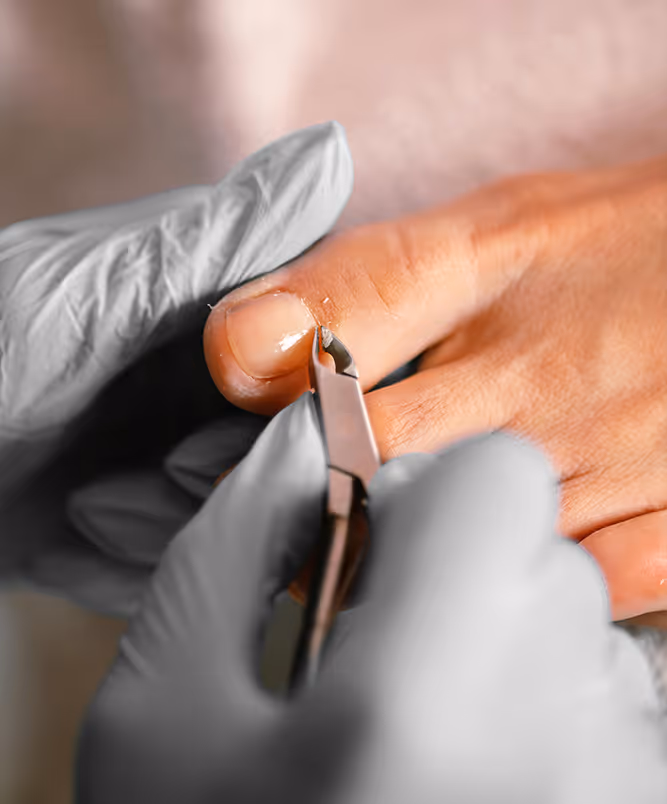 Herbal compounding options for nail fungus treatment