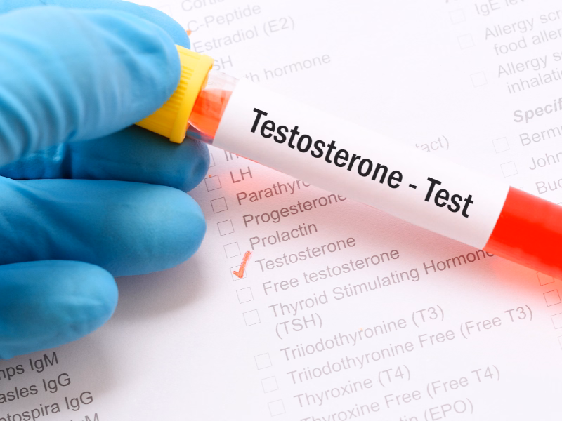 Understanding Testosterone and Its Role in Men's Health